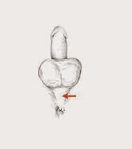 potencijos raumenys ir jų įtampa potencijai didinti